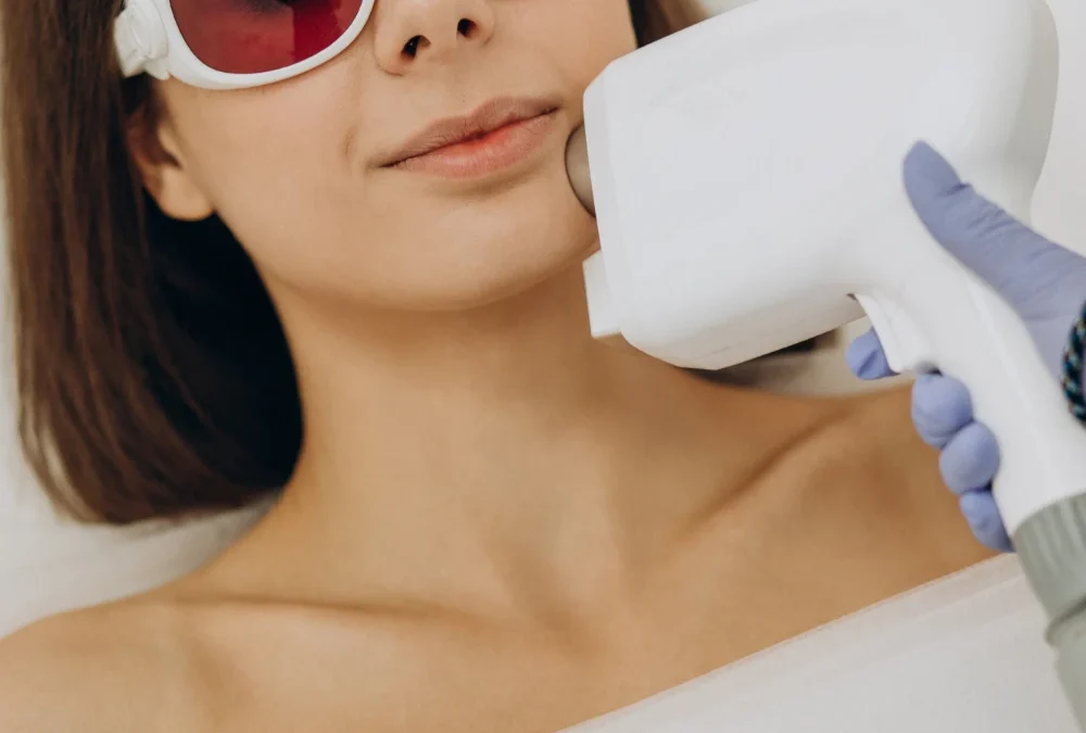 Epilazione definitiva Laser Viso